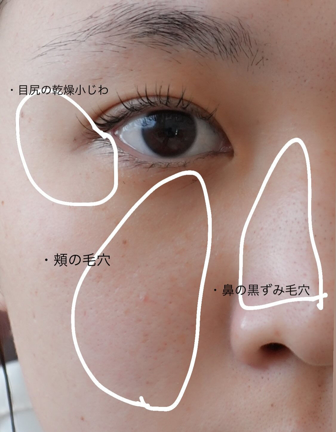 まずは2ヶ月間の集中ダクト！！