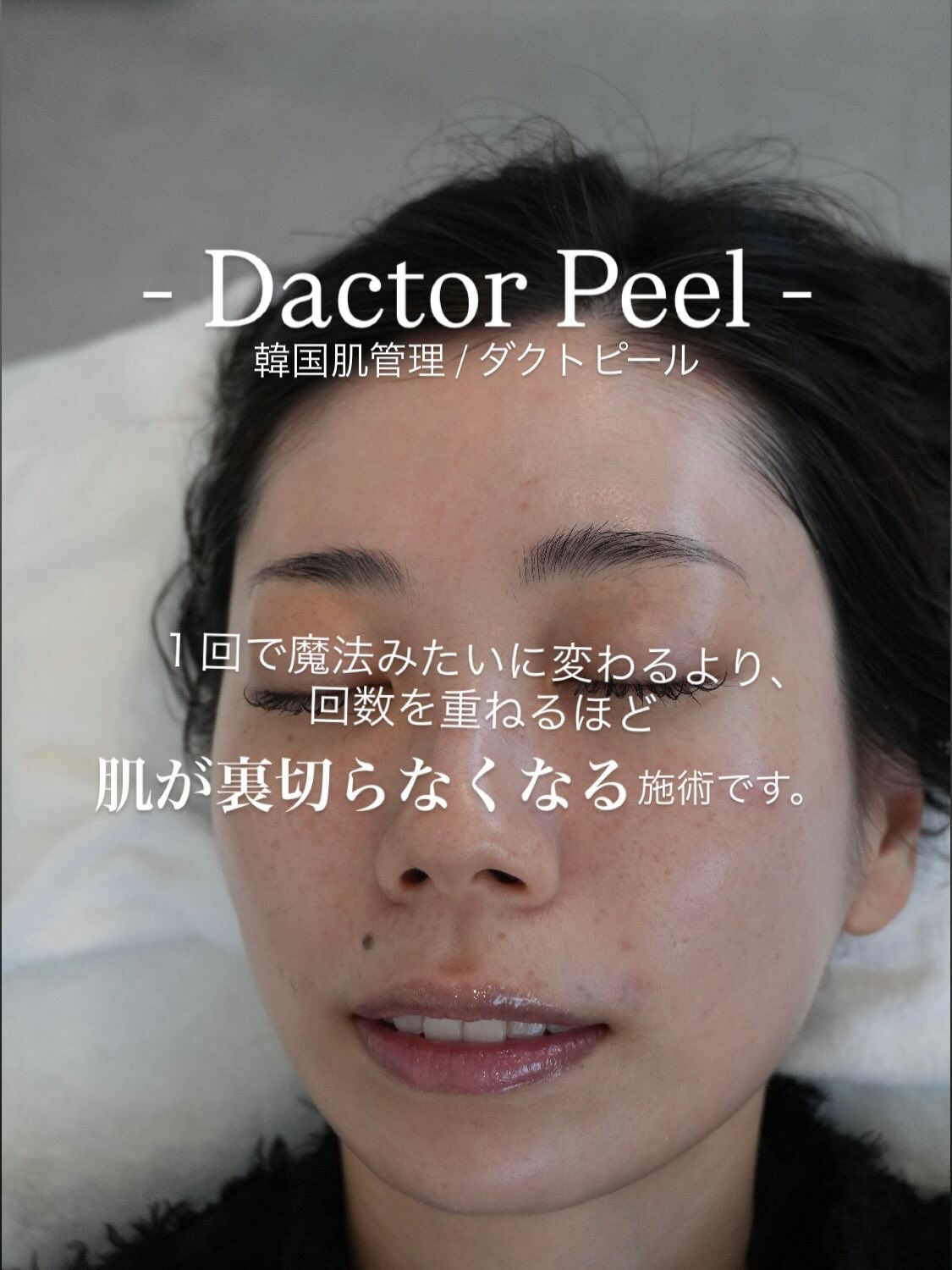 「1回で変わりますか？」