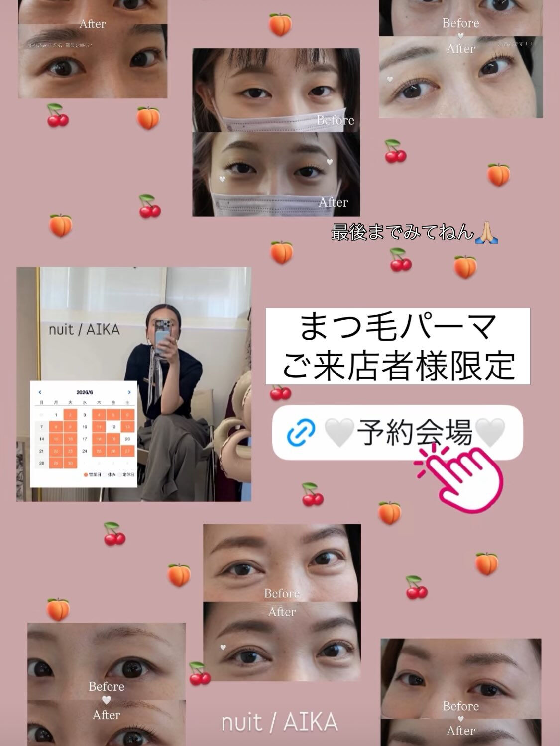 年齢が出る手、